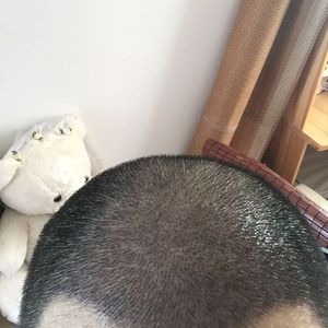 发际线分享社区
