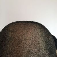 發(fā)際線用戶圖片