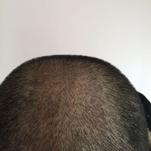 发际线分享社区