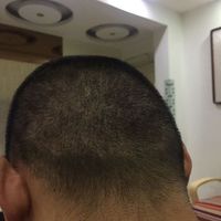 發(fā)際線用戶圖片