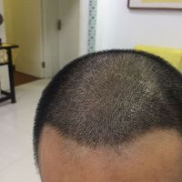 發(fā)際線用戶圖片