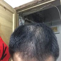 發(fā)際線用戶圖片