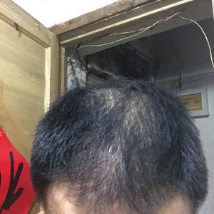 发际线分享社区