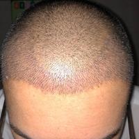 發(fā)際線用戶圖片