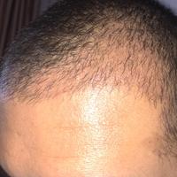 發(fā)際線用戶圖片