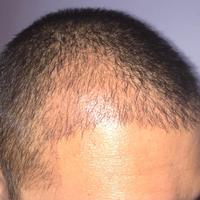 發(fā)際線用戶圖片