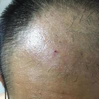 發(fā)際線用戶圖片