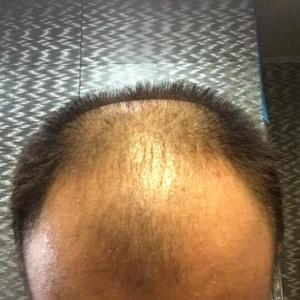 发际线分享社区