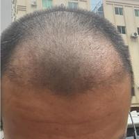 發(fā)際線用戶圖片