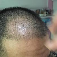 發(fā)際線用戶圖片