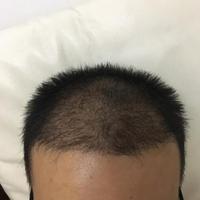 發(fā)際線用戶圖片