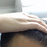 發(fā)際線用戶圖片