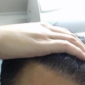 发际线分享社区