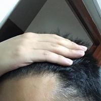 發(fā)際線用戶圖片