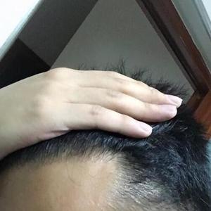 发际线分享社区