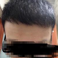 發(fā)際線用戶圖片