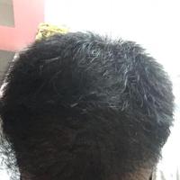 發(fā)際線用戶圖片