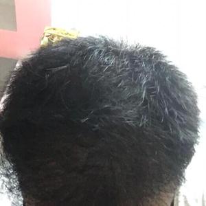 发际线分享社区