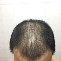 發(fā)際線用戶圖片