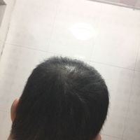 發(fā)際線用戶圖片