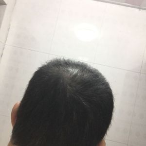 发际线分享社区
