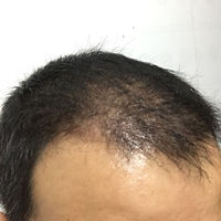 發(fā)際線用戶圖片