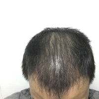 發(fā)際線用戶圖片