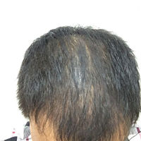 發(fā)際線用戶圖片