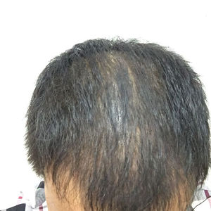 发际线分享社区