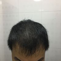 發(fā)際線用戶圖片