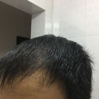 發(fā)際線用戶圖片