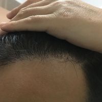 發(fā)際線用戶圖片