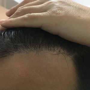 发际线分享社区