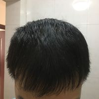 發(fā)際線用戶圖片