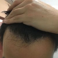 發(fā)際線用戶圖片