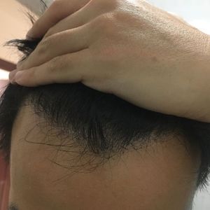 发际线分享社区