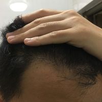 發(fā)際線用戶圖片