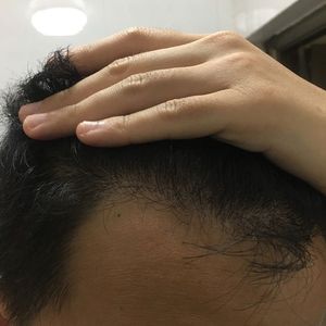 发际线分享社区