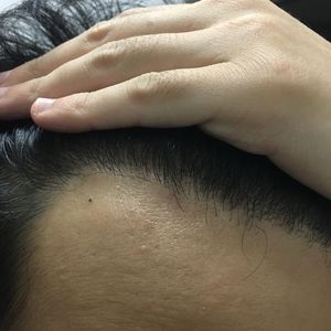 发际线分享社区