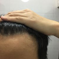 發(fā)際線用戶圖片