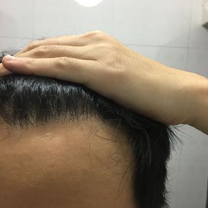 发际线分享社区