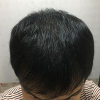 發(fā)際線用戶圖片