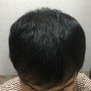 发际线分享社区