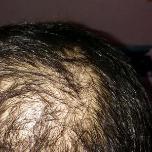 发际线分享社区