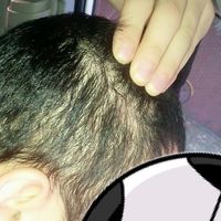 發(fā)際線用戶圖片