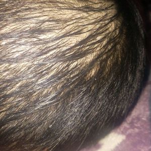 发际线分享社区