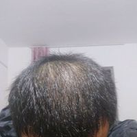 發(fā)際線用戶圖片