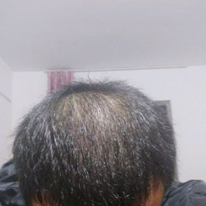 发际线分享社区
