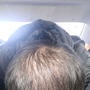 发际线分享社区