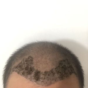 发际线分享社区